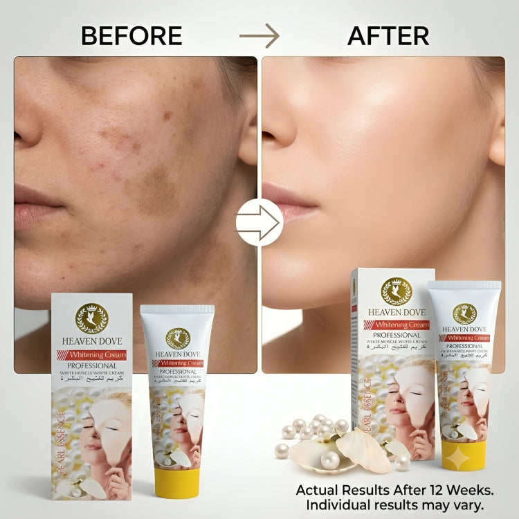 Heaven Dove Whitening Cream