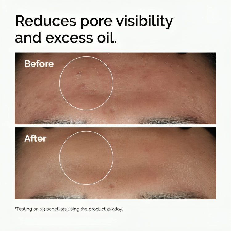 The Ordinary Niacinamide 10% + Zinc 1% 30ml - oraglowpk