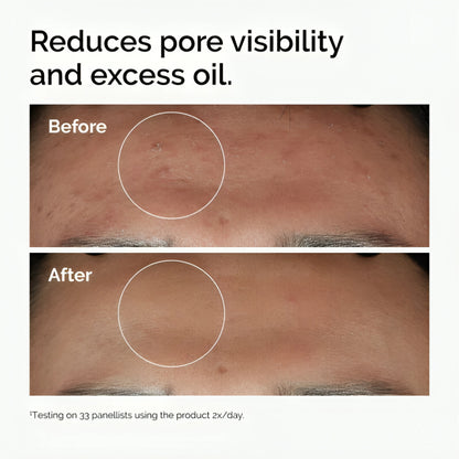 The Ordinary Niacinamide 10% + Zinc 1% 30ml - oraglowpk