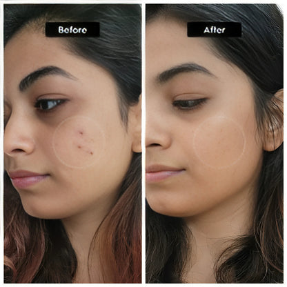 The Ordinary Niacinamide 10% + Zinc 1% 30ml - oraglowpk