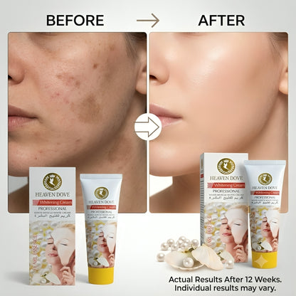 Heaven Dove Whitening Cream