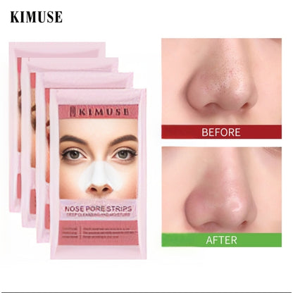 Emelie Deep Cleansing Nose Pore Strips - Witch Hazel Extracts - oraglowpk