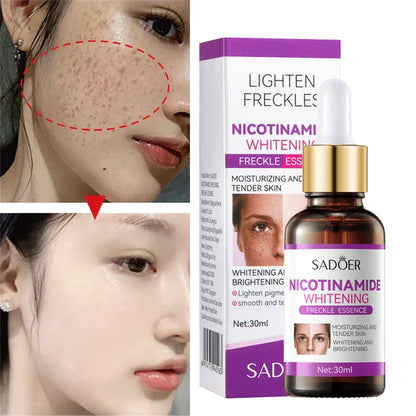 SADOER Nicotinamide Whitening Freckle Essence Serum 30ml - oraglowpk